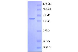 SDS-PAGE (SDS) image for 30S Ribosomal Protein S13 (AA 2-118), (full length) protein (GST tag) (ABIN1046324)