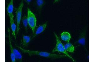 Image no. 3 for anti-L1 Cell Adhesion Molecule (L1CAM) (AA 1-1120) antibody (ABIN1995799)