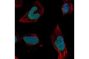 Image no. 1 for anti-WD Repeat Domain 3 (WDR3) antibody (ABIN5590880)