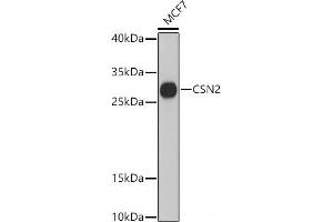 Western blot analysis of extracts of MCF7 cells using CSN2 Polyclonal Antibody at dilution of 1:3000.