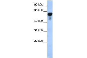 Image no. 2 for anti-Aldehyde Dehydrogenase 1 Family, Member B1 (ALDH1B1) (Middle Region) antibody (ABIN2774223)