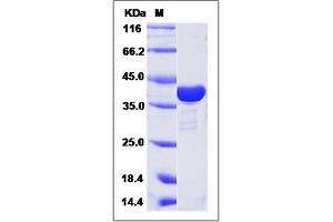 Image no. 1 for ADP-Ribosylarginine Hydrolase (ADPRH) (AA 1-351) protein (His tag) (ABIN2006498)