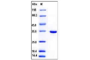 Image no. 1 for Sulfotransferase Family 1B Member 1 (SULT1B1) (AA 2-296) (Active) protein (His tag) (ABIN2004404)