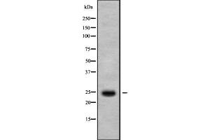 Image no. 1 for anti-Interleukin 37 (IL37) (N-Term) antibody (ABIN6262546)