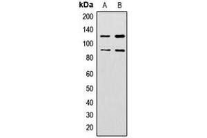 Image no. 1 for anti-Zinc Finger Protein 148 (ZNF148) (N-Term) antibody (ABIN2707788)