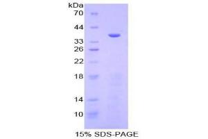 Image no. 1 for Meprin A, alpha (PABA Peptide Hydrolase) (MEP1A) (AA 213-506) protein (His tag) (ABIN1879545)