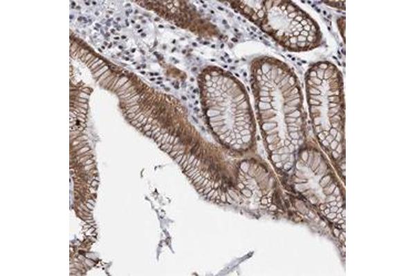 ZNF609 antibody