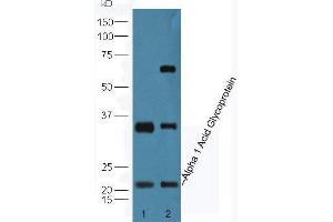 Image no. 1 for anti-Orosomucoid 1 (ORM1) (AA 101-201) antibody (ABIN872553)