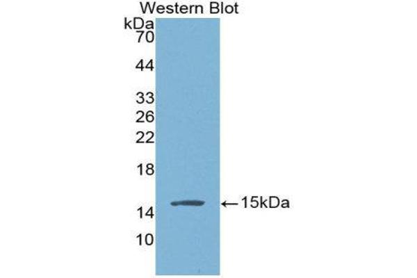 anti-Brain Natriuretic Peptide (BNP) (AA 27-134) antibody