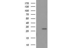 Image no. 2 for anti-Bridging Integrator 3 (BIN3) antibody (ABIN1496922)