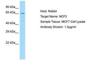 Image no. 1 for anti-Neutrophil Cytosolic Factor 2 (NCF2) (AA 429-478) antibody (ABIN6749984)