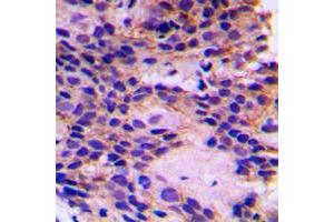 Image no. 1 for anti-Peroxisomal Biogenesis Factor 7 (PEX7) (Center) antibody (ABIN2706797)