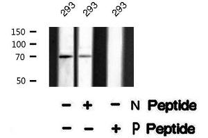 Image no. 1 for anti-CREB Regulated Transcription Coactivator 2 (CRTC2) (pSer171) antibody (ABIN6271822)