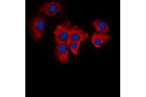 Image no. 2 for anti-KDEL (Lys-Asp-Glu-Leu) Endoplasmic Reticulum Protein Retention Receptor 2 (KDELR2) (Center) antibody (ABIN2972641)