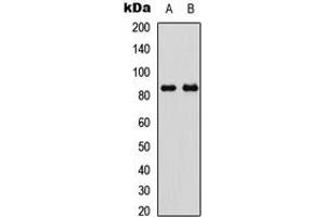 Image no. 2 for anti-Glycogen Synthase 1 (Muscle) (GYS1) (C-Term), (pSer645) antibody (ABIN2704870)