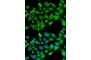 Image no. 3 for anti-Retinoblastoma Binding Protein 7 (RBBP7) antibody (ABIN6570817)