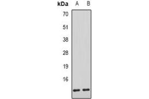 Image no. 1 for anti-alpha Hemoglobin Stabilizing Protein (aHSP) (full length) antibody (ABIN6004334)