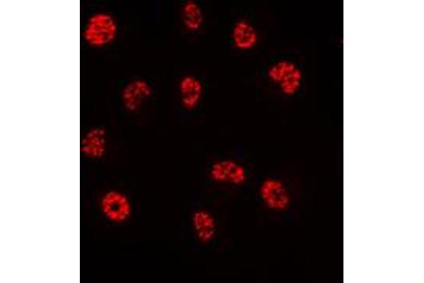 ERF antibody  (C-Term)