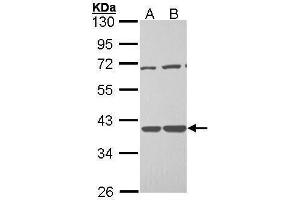 Image no. 1 for anti-Tissue Specific Transplantation Antigen P35B (TSTA3) (C-Term) antibody (ABIN2855117)