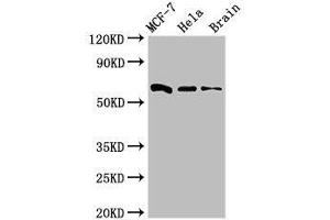 Image no. 2 for anti-Shugoshin 1 (SGOL1) (AA 260-439) antibody (ABIN6090168)