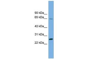 Image no. 1 for anti-Dihydrofolate Reductase-Like 1 (DHFRL1) (Middle Region) antibody (ABIN2785349)