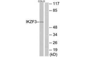 Image no. 1 for anti-IKAROS Family Zinc Finger 3 (Aiolos) (IKZF3) (AA 361-410) antibody (ABIN1534187)