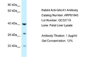 Image no. 1 for anti-Galactokinase 1 (GALK1) (C-Term) antibody (ABIN2788956)