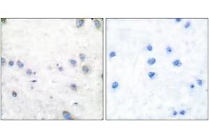 Immunohistochemistry analysis of paraffin-embedded human brain, using COT (Phospho-Thr290) Antibody.
