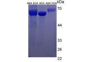 Image no. 1 for Abscisic Acid (ABA) peptide (BSA) (ABIN5665933)