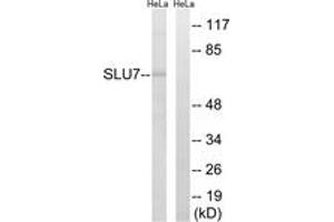 Image no. 1 for anti-SLU7 Splicing Factor Homolog (SLU7) (AA 113-162) antibody (ABIN1535202)
