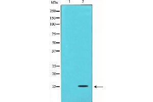 Image no. 2 for anti-Transforming Growth Factor, beta 3 (TGFB3) antibody (ABIN6265548)