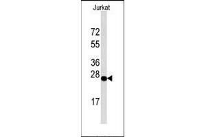 Image no. 1 for anti-DNA-Damage-Inducible Transcript 4 (DDIT4) (C-Term), (N-Term) antibody (ABIN358765)