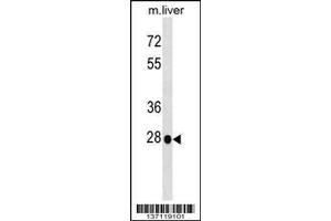 Image no. 1 for anti-Homeobox B5 (HOXB5) (AA 1-30), (N-Term) antibody (ABIN1538818)