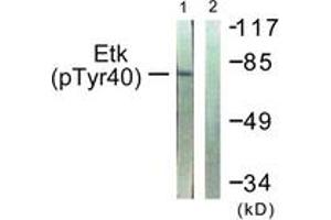 Western blot analysis of extracts from HepG2 cells, using ETK (Phospho-Tyr40) Antibody.