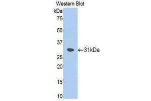 Image no. 1 for anti-Fascin (FSCN1) (AA 8-260) antibody (ABIN1174989)