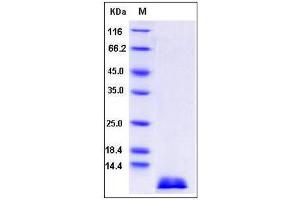 Image no. 1 for Chemokine (C-C Motif) Ligand 17 (CCL17) (AA 1-93) protein (ABIN2007228)