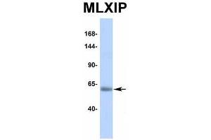 Image no. 3 for anti-MLX Interacting Protein (MLXIP) (Middle Region) antibody (ABIN2776519)