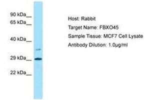Image no. 1 for anti-F-Box Protein 45 (FBXO45) (AA 107-156) antibody (ABIN6749879)