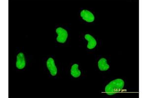 Immunofluorescence of monoclonal antibody to ZNF394 on HeLa cell.