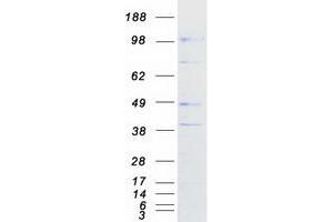 Image no. 1 for Chloride Channel Accessory 2 (CLCA2) protein (Myc-DYKDDDDK Tag) (ABIN2712858)