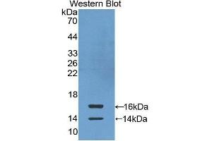 Image no. 1 for anti-Chemokine (C-C Motif) Ligand 24 (CCL24) antibody (FITC) (ABIN1862929)