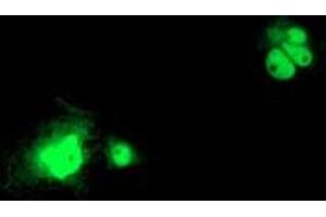 Image no. 2 for anti-LSM1 Homolog, U6 Small Nuclear RNA Associated (LSM1) (AA 1-133) antibody (ABIN2724971)