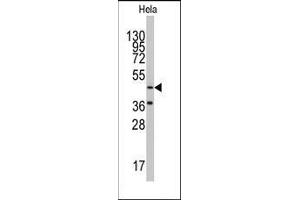 Image no. 2 for anti-Nuclear Autoantigenic Sperm Protein (Histone-Binding) (NASP) (C-Term) antibody (ABIN359758)