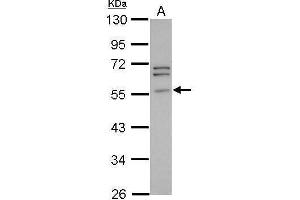 Image no. 2 for anti-Peripherin (PRPH) (Center) antibody (ABIN2855255)