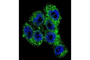 Image no. 1 for anti-Transient Receptor Potential Cation Channel, Subfamily M, Member 8 (TRPM8) (AA 270-300), (Middle Region) antibody (ABIN955341)