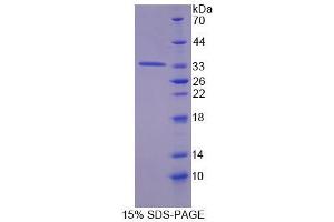 Image no. 1 for tyrosine Aminotransferase (TAT) (AA 190-454) protein (ABIN6239442)