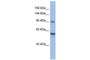 Image no. 2 for anti-CDKN1A Interacting Zinc Finger Protein 1 (CIZ1) (Middle Region) antibody (ABIN2775710)