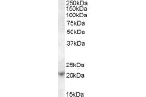 Image no. 1 for anti-ASF1 Anti-Silencing Function 1 Homolog A (S. Cerevisiae) (ASF1A) (C-Term) antibody (ABIN238604)