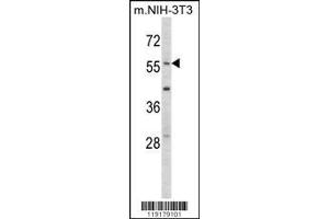 Image no. 2 for anti-Early Growth Response 1 (EGR1) (AA 9-37), (N-Term) antibody (ABIN389442)