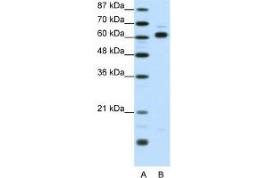 Image no. 1 for anti-Thyroid Hormone Receptor Interactor 4 (TRIP4) (Middle Region) antibody (ABIN2776529)